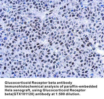 Glucocorticoid Receptor beta antibody [N1N3], GeneTex