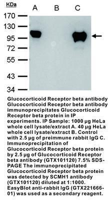 Glucocorticoid Receptor beta antibody [N1N3], GeneTex