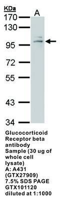 Glucocorticoid Receptor beta antibody [N1N3], GeneTex