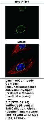 Lamin A/C antibody - Rabbit Polyclonal - ICC/IF, IHC-P, WB - 100µl, GeneTex