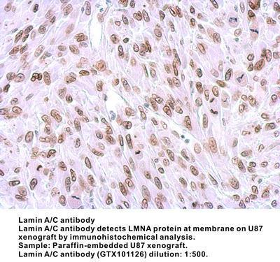 Lamin A/C antibody - Rabbit Polyclonal - ICC/IF, IHC-P, WB - 100µl, GeneTex