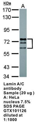 Lamin A/C antibody - Rabbit Polyclonal - ICC/IF, IHC-P, WB - 100µl, GeneTex