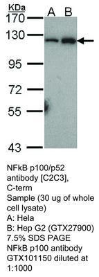 NFkB p100/p52 antibody [C2C3], C-term, GeneTex