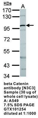 beta Catenin antibody [N3C3], GeneTex