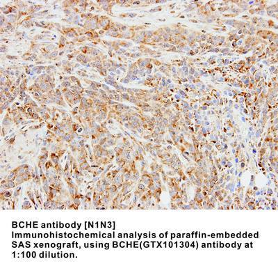 BCHE antibody [N1N3], GeneTex