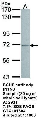 BCHE antibody [N1N3], GeneTex