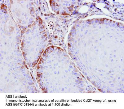 ASS1 antibody [N1N3], GeneTex