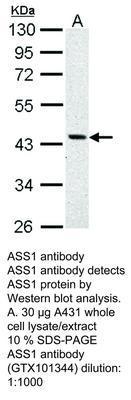 ASS1 antibody [N1N3], GeneTex