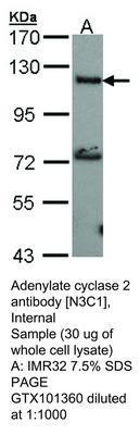 Adenylate cyclase 2 antibody [N3C1], Internal, GeneTex