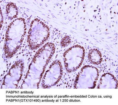 PABPN1 antibody, GeneTex