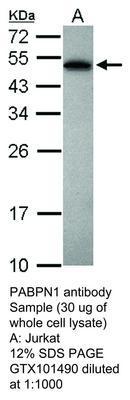 PABPN1 antibody, GeneTex