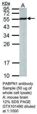 PABPN1 antibody, GeneTex