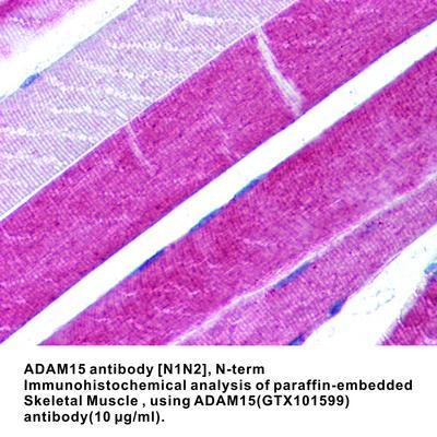 ADAM15 antibody [N1N2], N-term, GeneTex