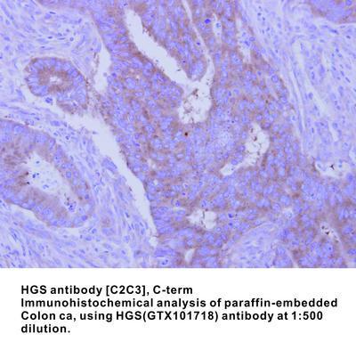 HGS antibody [C2C3], C-term, GeneTex