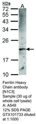 Ferritin Heavy Chain antibody [N1C3], GeneTex