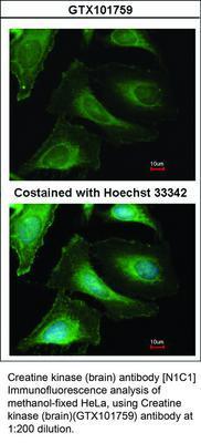 Creatine kinase (brain) antibody [N1C1], GeneTex