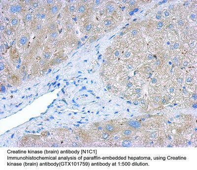 Creatine kinase (brain) antibody [N1C1], GeneTex