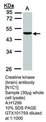 Creatine kinase (brain) antibody [N1C1], GeneTex