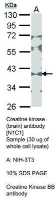 Creatine kinase (brain) antibody [N1C1], GeneTex