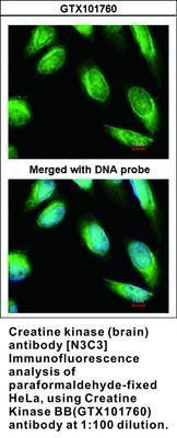 Creatine kinase (brain) antibody [N3C3], GeneTex