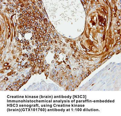 Creatine kinase (brain) antibody [N3C3], GeneTex