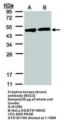 Creatine kinase (brain) antibody [N3C3], GeneTex