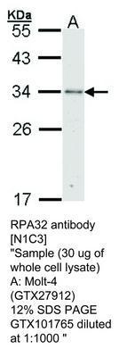 RPA32 antibody [N1C3], GeneTex