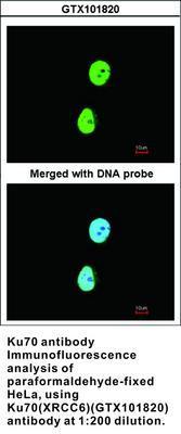 Ku70 antibody - Rabbit Polyclonal - ICC/IF, IHC-P, WB - 100µl, GeneTex