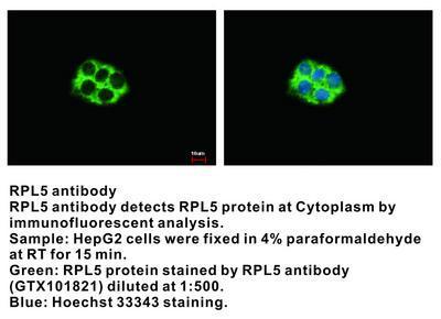 RPL5 antibody, GeneTex