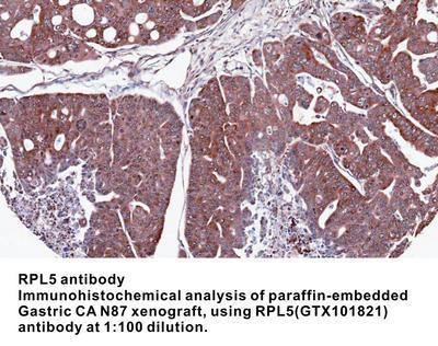 RPL5 antibody, GeneTex