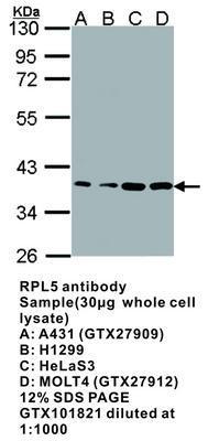 RPL5 antibody, GeneTex