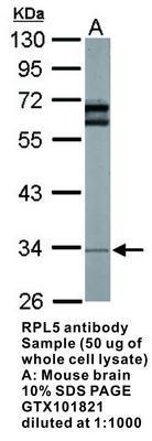 RPL5 antibody, GeneTex