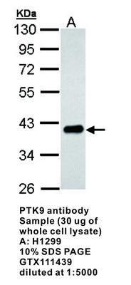 PTK9 antibody, GeneTex