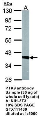 PTK9 antibody, GeneTex