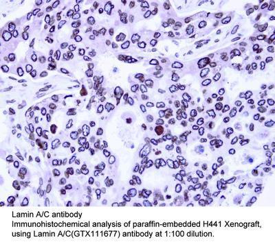 Lamin A/C antibody - Rabbit Polyclonal - IHC-P, WB - 100µl, GeneTex