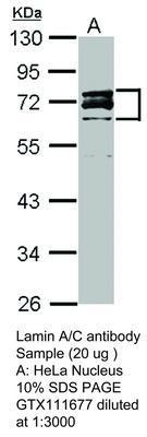 Lamin A/C antibody - Rabbit Polyclonal - IHC-P, WB - 100µl, GeneTex