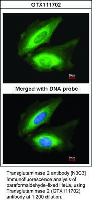 Transglutaminase 2 antibody [N3C3], GeneTex