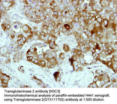 Transglutaminase 2 antibody [N3C3], GeneTex