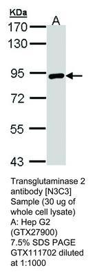 Transglutaminase 2 antibody [N3C3], GeneTex