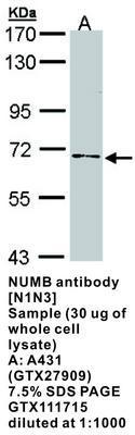 NUMB antibody [N1N3], GeneTex