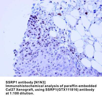 SSRP1 antibody [N1N3], GeneTex