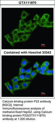 Calcium binding protein P22 antibody [N2C2], Internal, GeneTex