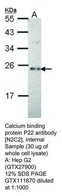 Calcium binding protein P22 antibody [N2C2], Internal, GeneTex