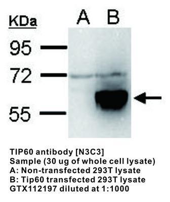 TIP60 antibody [N3C3], GeneTex