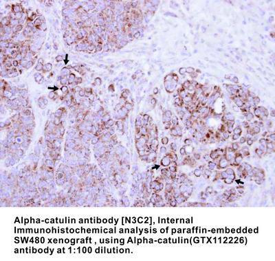 Alpha-catulin antibody [N3C2], Internal, GeneTex