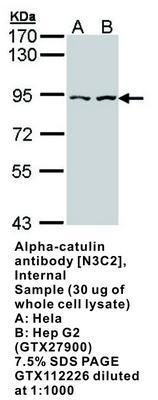 Alpha-catulin antibody [N3C2], Internal, GeneTex