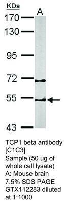 TCP1 beta antibody [C1C3], GeneTex