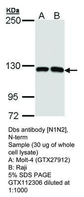 Dbs  antibody [N1N2], N-term, GeneTex