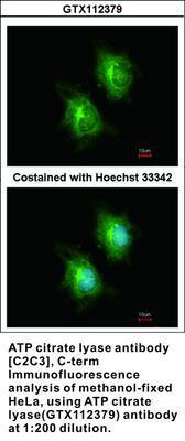 ATP citrate lyase antibody [C2C3], C-term, GeneTex