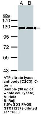 ATP citrate lyase antibody [C2C3], C-term, GeneTex